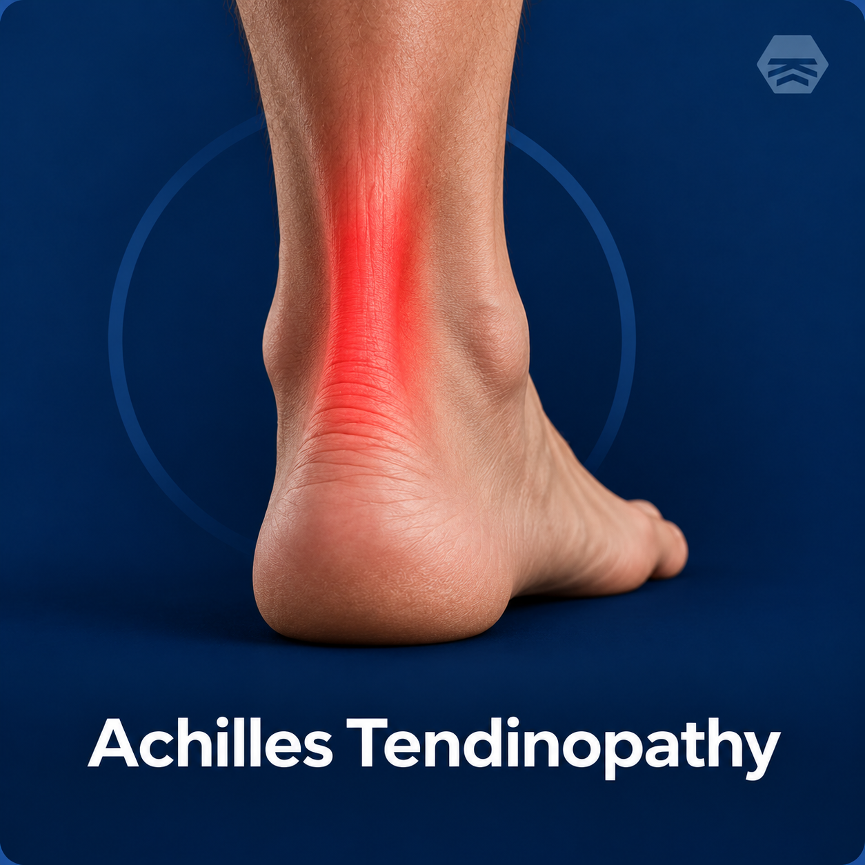 Achilles Tendinopathy