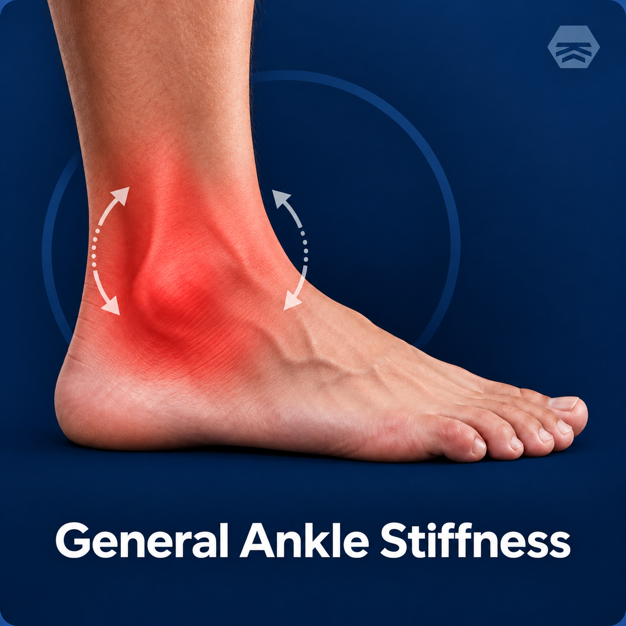 General Ankle Stiffness